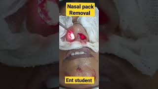 Nasal pack removal [upl. by Winou]