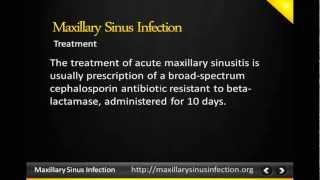 Maxillary sinus infection Maxillary sinus [upl. by Lilaj]