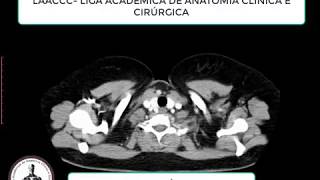 Anatomia Seccional do Tórax  Janela Mediastinal [upl. by Gnek]