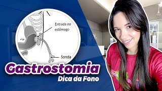 GASTROSTOMIA Cuidados Indispensáveis  Fonoaudiologia [upl. by Atiekal]