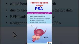 Why is a PSA level elevated psa prostateproblems prostatecancer [upl. by Kiefer]