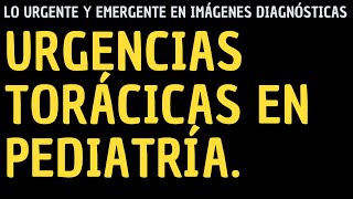 Urgencias torácicas en pediatría [upl. by Cavil]