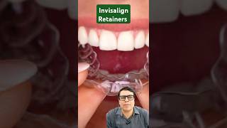 Invisalign retainer shortsviral shortvideo shorts short [upl. by Xavier990]