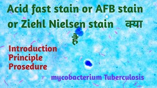 acid fast staining procedure and principle in Hindi  ZN stain  AFB stain [upl. by Wendeline]