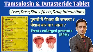 Tamsulosin hydrochloride and dutasteride tablet uses dose side effects in hindi  Urimax d tablet [upl. by Seroka]