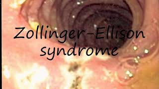 How to Pronounce ZollingerEllison syndrome [upl. by Eiznik279]