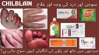 Chilblains causes and treatment سردیوں میں ہاتھ پاؤں کی انگلیاں کیوں سوج جاتی ہےدرد کی وجہ اور علاج [upl. by Felicio348]