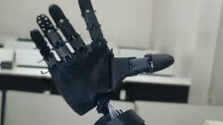 Lowcost MyoElectric Prosthetic Arm [upl. by Stringer955]