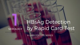 HBsAg Detection by Rapid Card Test [upl. by Sadirah361]