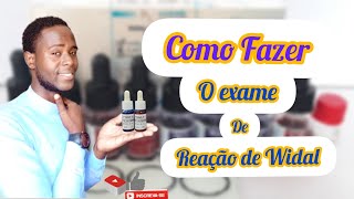 COMO FAZER O EXAME DE REAÇÃO DE WIDAL Parte 1 [upl. by Ecirtael]