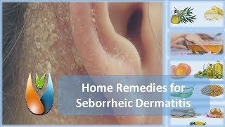 Home Remedies for Seborrheic Dermatitis [upl. by Anez]