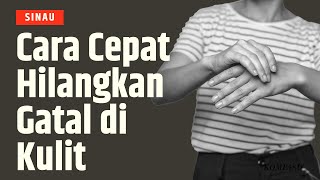 Tips Atasi Gatal di Kulit SINAU [upl. by Erret]