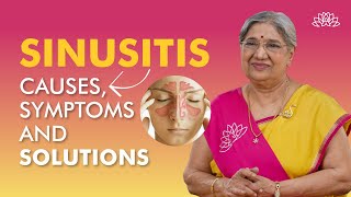 What is Sinusitis  Sinusitis Causes Symptoms amp Treatment  Sinus Infection  Dr Hansaji [upl. by Nonnaihr302]