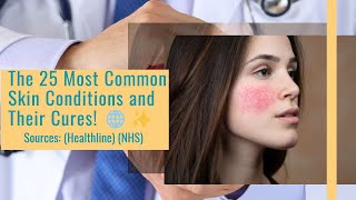 The 25 Most Common Skin Conditions and Their Cures  Skin Care  Dermatologist Advice [upl. by Herv]