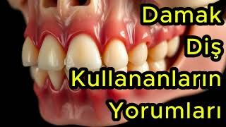 Damak Diş Kullananların Yorumları [upl. by Aleik]