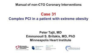 Case 31 PCI Manual  PCI and extreme obesity [upl. by Carberry227]