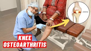 Knee Osteoarthritis Chiropractic Treatment I Dr Sanjay Sarkar USA I Call 9903026262 [upl. by Lancaster]