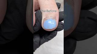 Toenail Glow Up waterlesspedicure drypedicure footcare toenails deadskin satisfying nailtech [upl. by Naashom]