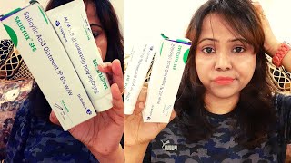 My 1 Month Experience  Salicylic Acid Ointment IP 6  SALICYLIX SF6 [upl. by Esertal]