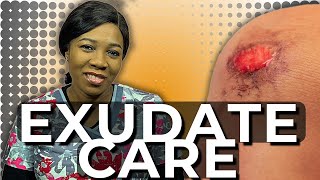 How to assess and manage wound exudate at home [upl. by Salomi]