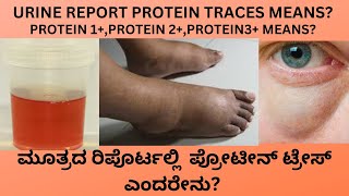 PROTEIN PRESENTTRACES IN URINE CAUSES SYMPTOMS AND TREATMENT OF PROTEIN IN URINE IN KANNADA [upl. by Annav]