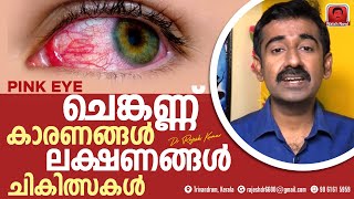 Conjunctivitis Pinkeye Causes Symptoms and Treatments [upl. by Baxy]