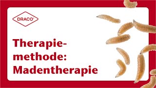 Therapiemethode Madentherapie [upl. by Hanahs]