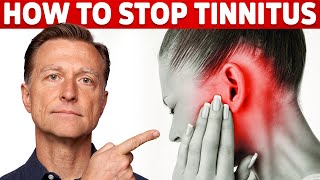 How to Stop Tinnitus ringing in the ears – Try DrBergs Home Remedy to Get Rid of It [upl. by Steiner]