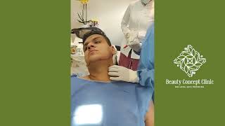 Me Hicieron Lipo de Papada Bichectomia y Perfilamiento Facial SalmitaBebe [upl. by Banna]