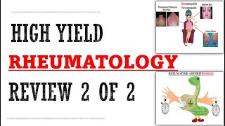 Rheumatology Part 2 of 2 Review  Mnemonics And Proven Ways To Memorize For Your Exams [upl. by Pickett106]