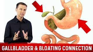 Gallbladder amp Bloating Connection Part 1 – DrBerg Bloated Stomach amp Gallbladder Function [upl. by Atiuqad38]