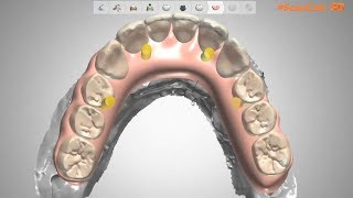 Fast 3shape gingiva [upl. by Gwenni10]