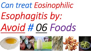 Eosinophilic esophagitis diet symptoms diagnosis treatment causes elimination diet [upl. by Woolley252]