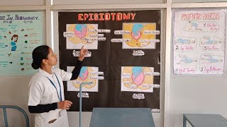 explanation about episiotomy procedure🧑‍⚕️ shortvideo exploremore exploremore episiotomy nurse [upl. by Ibloc]