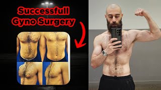 My Entire Gynecomastia Surgery Experience Plus Dos amp Donts [upl. by Ring379]