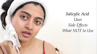 What is Salicylic Acid  👉🏻 Side Effects Uses Benefits Oily Acne Skin  Superwowstyle [upl. by Zenger]