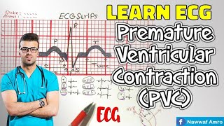 معلومة جديدة حول الانقباض المبكر للبطين Learn ECG  Premature Ventricular Contraction PVC [upl. by Ekez]