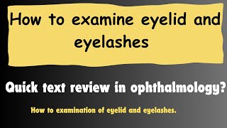 examination of eyelid  How to check eyelids and eyelashes OptometryFans [upl. by Komarek]