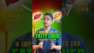 Fatty Liver The 4 Tests You NEED [upl. by Milty]