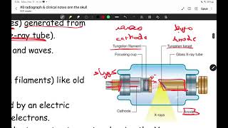 head amp neck anatomy II lecture 8 radiography and clinical notes on skull II majed rumman [upl. by Shell]