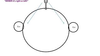 Weber vs Rinne Test amp Conductive vs Sensorineural Hearing Loss [upl. by Oijimer]