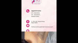 Underarm Whitening Laser Treatment  Laser Underarmwhitening  Carbon Laserhairremoval [upl. by Kathe]