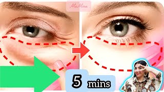 5mins 💯 AntiAging Face Exercise For Eye Bags  Eye Wrinkles  Dark Circles [upl. by Ayardna]