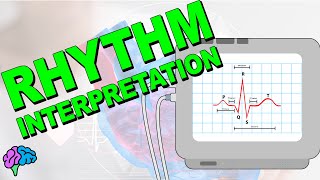 The Complete ECG Rhythm Interpretation Series [upl. by Hgielram878]