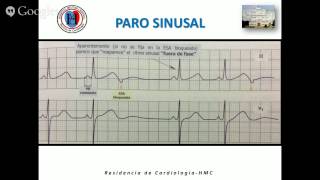 MODULO DE ECG [upl. by Rigby]