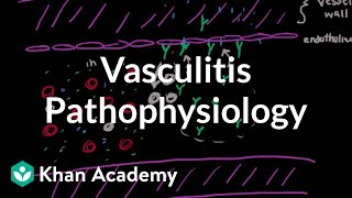 Vasculitis pathophysiology  Circulatory System and Disease  NCLEXRN  Khan Academy [upl. by Inait]