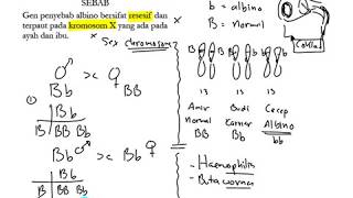 Hereditas pada Manusia Albino [upl. by Meletius]