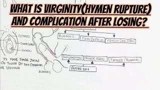 What Is VirginityRupture HymenAnd ComplicationSignSymptoms After It [upl. by Nerac]