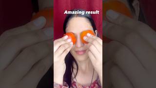 Get rid of eye bags😍skincare youtubeshorts home madehomeremedies shortvideo eyecarediy [upl. by Iknarf]