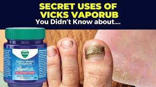 5 Secret Uses of Vicks VapoRub You Didnt Know About [upl. by Letnuhs184]